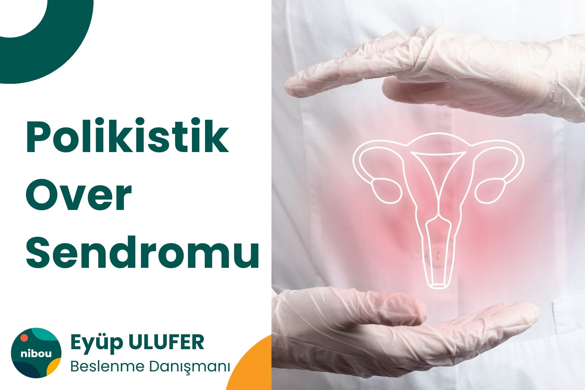 Polikistik Over Sendromu (PKOS) ve Beslenme