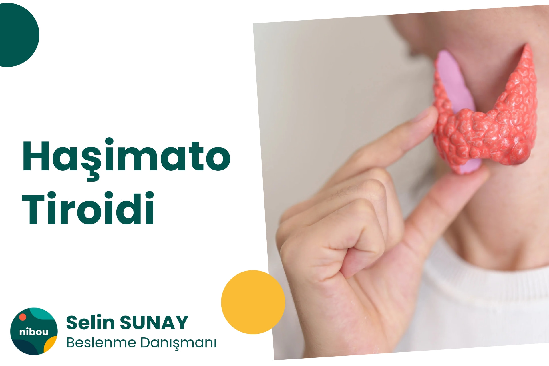 Haşimato Tiroidi