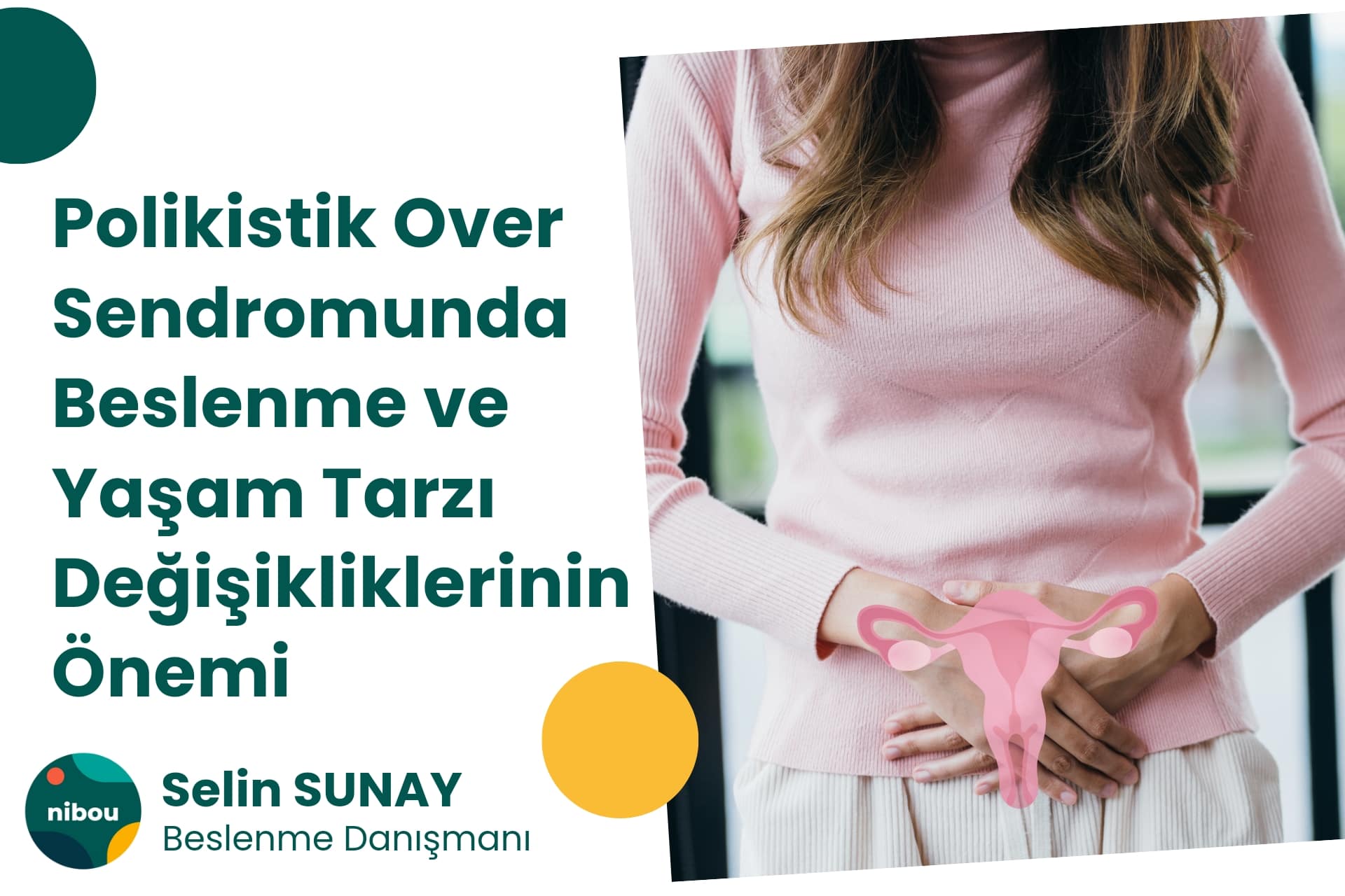 Polikistik Over Sendromunda Beslenme ve Yaşam Tarzı Değişikliklerinin Önemi